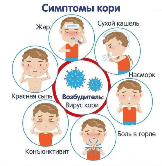 ПРОФИЛАКТИКА КОРИ. ПРОФИЛАКТИКА КОРИ.